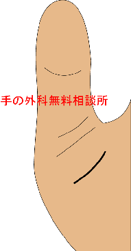 ばね指の手術, 皮膚切開